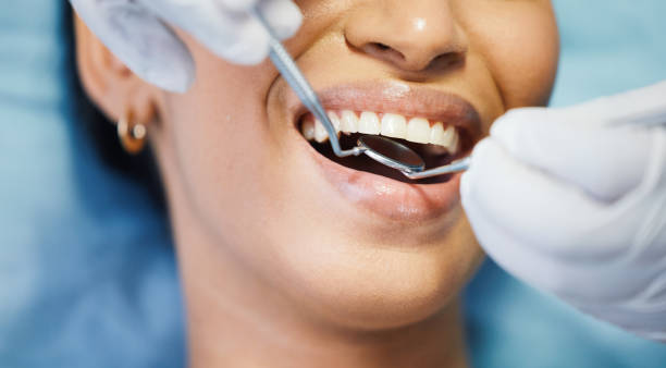 Best Broken or Chipped Tooth Repair in Hlside, IL