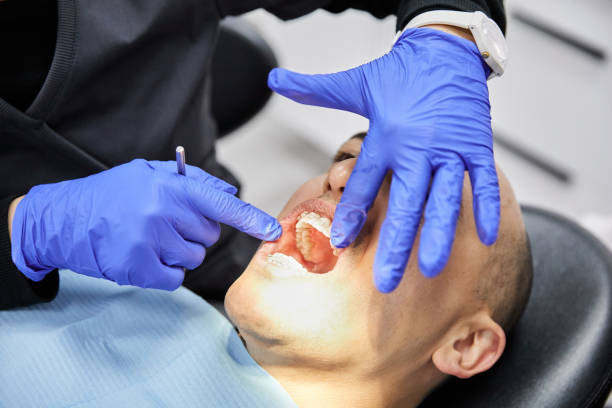Best Knocked-Out Tooth (Avulsed Tooth) Treatment in Hlside, IL